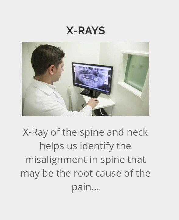 X-rays